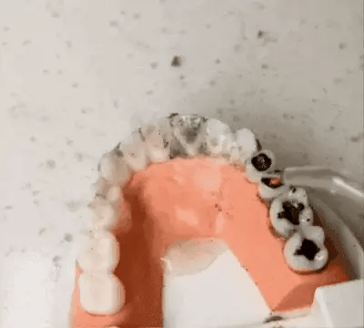 Irrigador Bucal Portátil